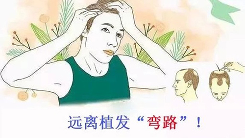 植发效果